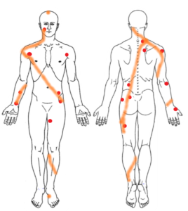 改善事例 肘の痛み トリガーポイント 筋膜アプローチ専門 痛みケア整体院柏のホームページ